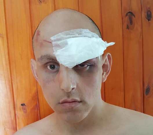 Un joven denunció haber sido brutalmente golpeado por patovicas en un boliche nocturno de Ramallo por su condición sexual. La victima debió ser internada de urgencia en el Hospital San Felipe, producto de los golpes en su cabeza.
