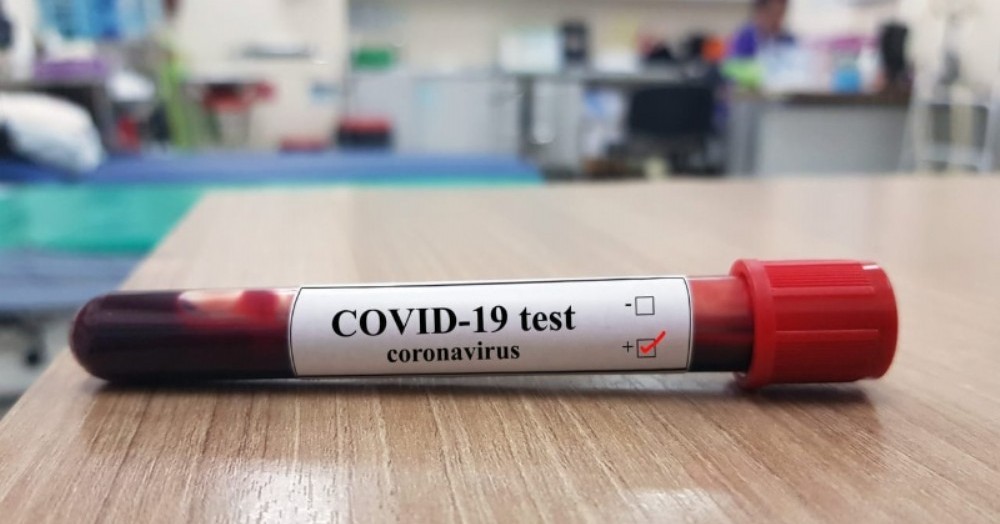 Cabe aclarar que desde el área de Salud notificaron que existen 72 casos activos de Covid-19 y 50 en estudios.