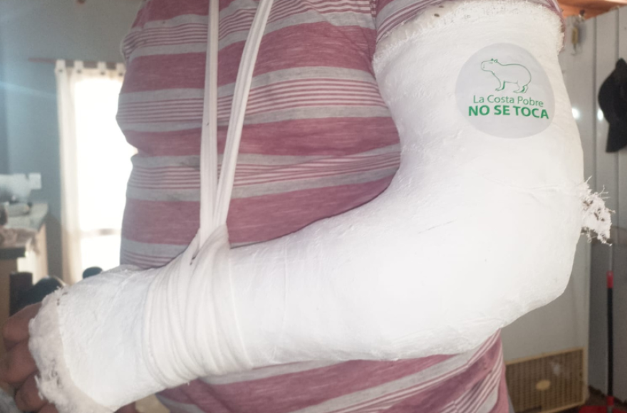 Un vecino fue brutalmente agredido con palos y sufrió la fractura del antebrazo izquierdo.